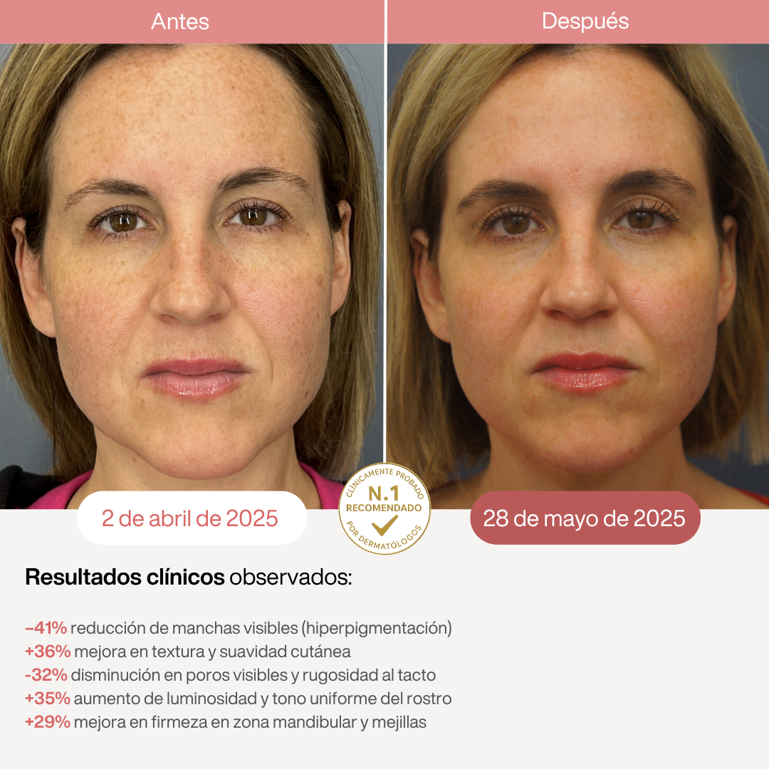 Máscara LED Infrarroja Profesional - 850nm