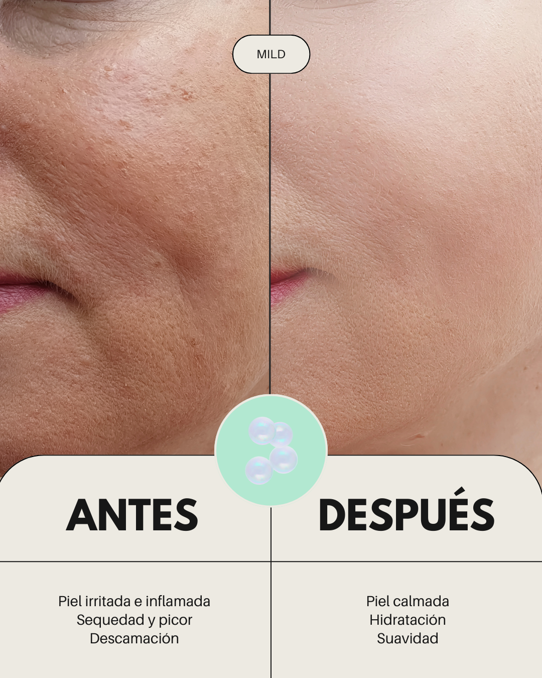 Sérum Facial Calmante Pieles Sensibles con Rojeces MILD